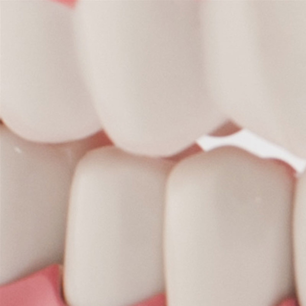 Dental Jaw Model - Image 4